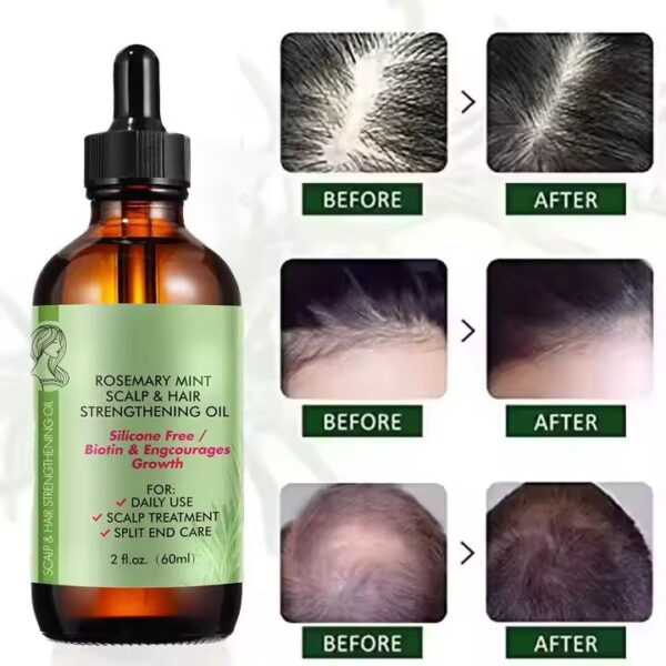 Huile de Romarin Menthe – Soin Cheveux & Cuir Chevelu 60ml – Image 8